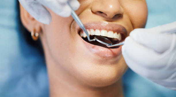 Best Emergency Tooth Extraction  in Liberty Hill, TX